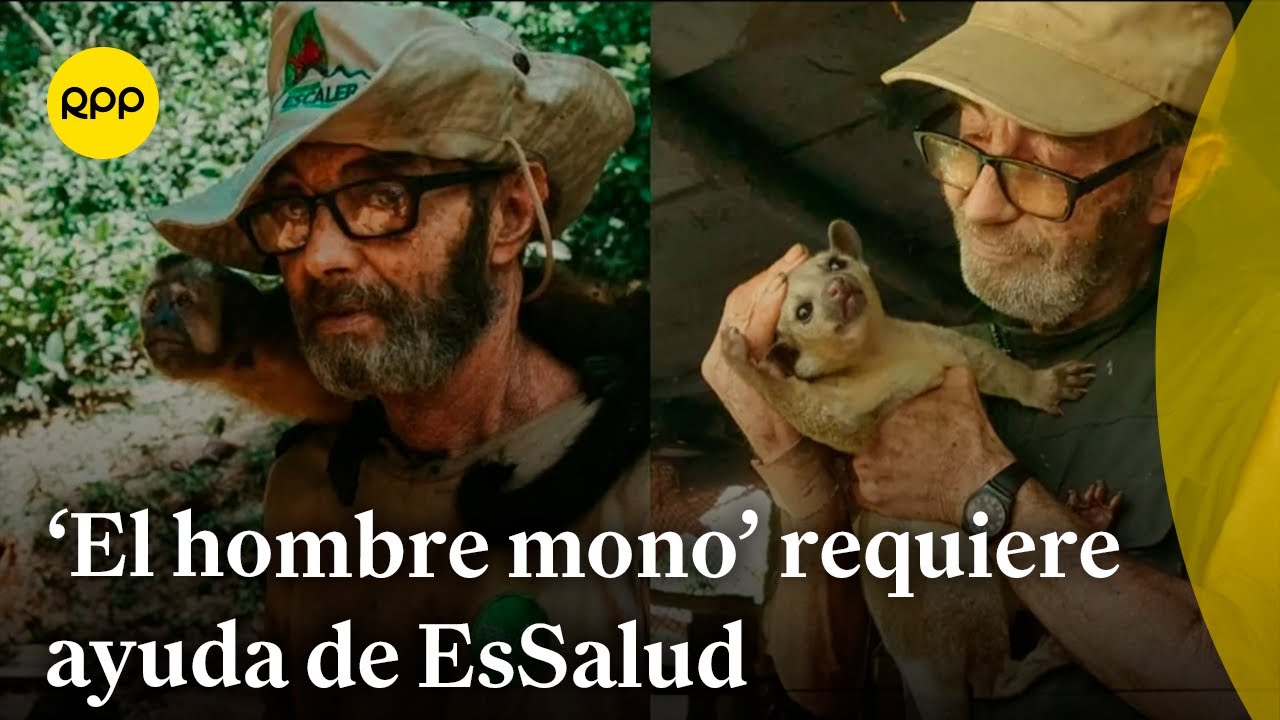 Orlando Zagazeta, 'El hombre mono', requiere ayuda de las autoridades de EsSalud