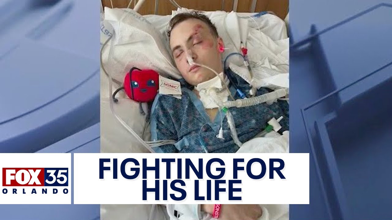 UCF student fighting for his life after getting hit by car while on the way to work