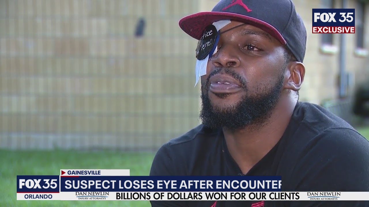 Florida man missing eye after K9 attack, police say